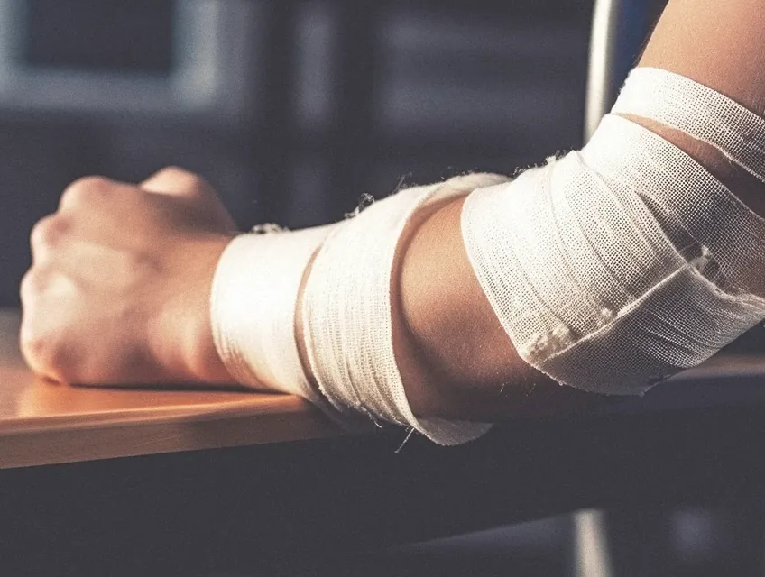 Delito leve de lesiones: qué es y qué consecuencias tiene. 2 Delito leve de lesiones